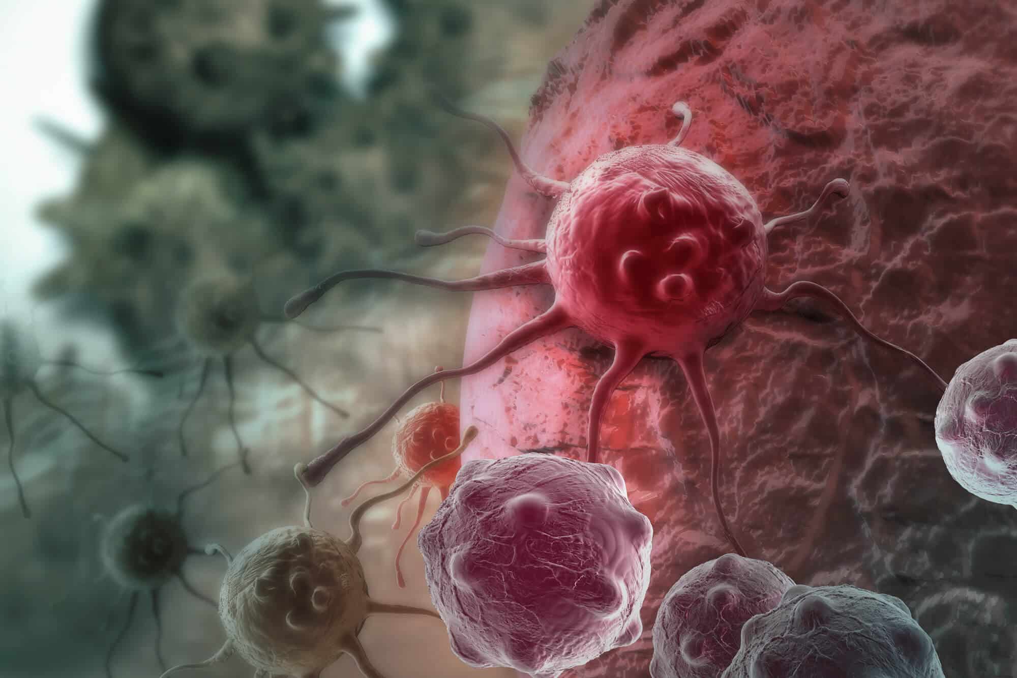 cancer cell  Illustration: depositphotos.com