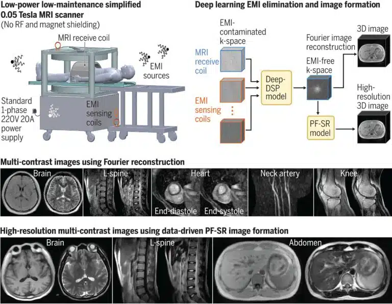 כיצד פועלים MRI קונבנציונלי (משמאל) והמכשיר הביתי (מימין)