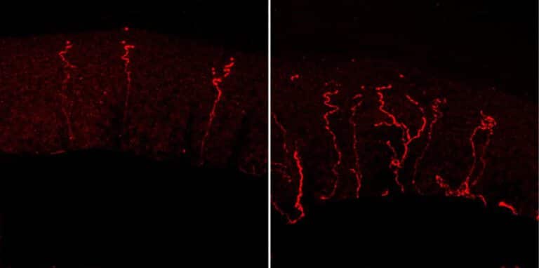 הגנן המסור: מחסור בחלבון Kif2a הוביל לגידול פרא של סיבי העצבים בעור של עכברים בוגרים (מימין), בעוד בעכברים ללא מחסור בחלבון השלוחות העצביות טופחו בקפדנות (משמאל)